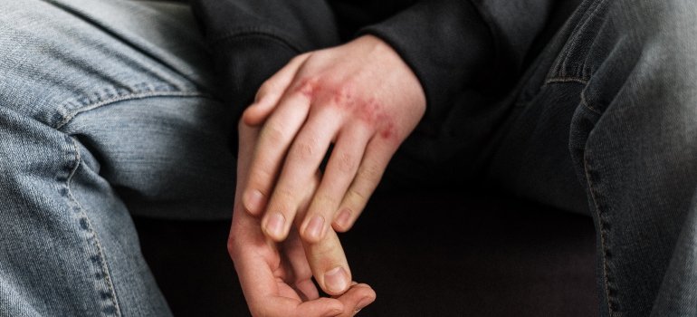 person with sore knuckles