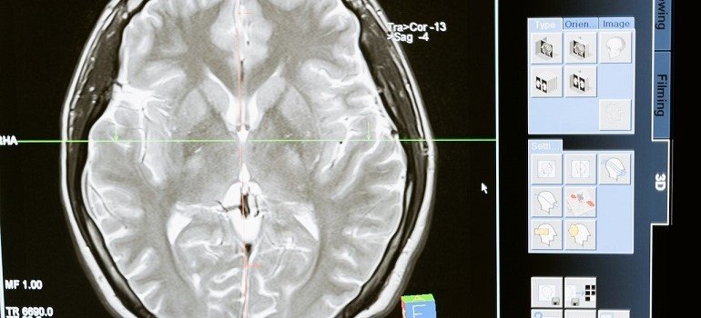 Scientists can't fully agree is THC a depressant or not.