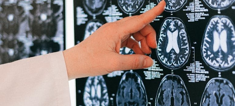 Doctor pointing to an MRI of a brain