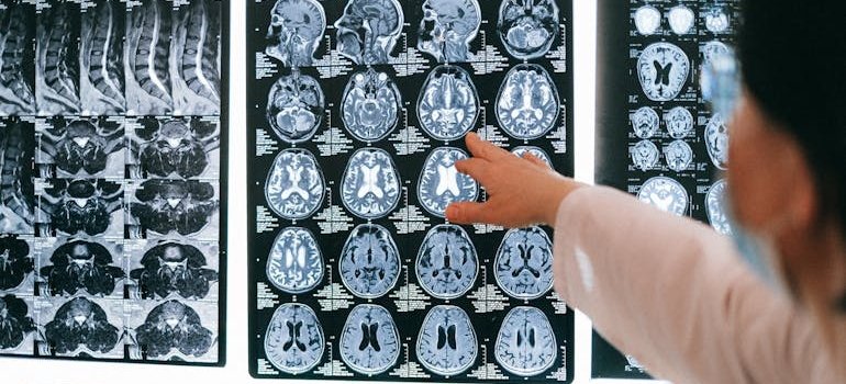 Doctor pointing out how drugs influence a person's emotions, perceptions, and behavior on a brain MRI.