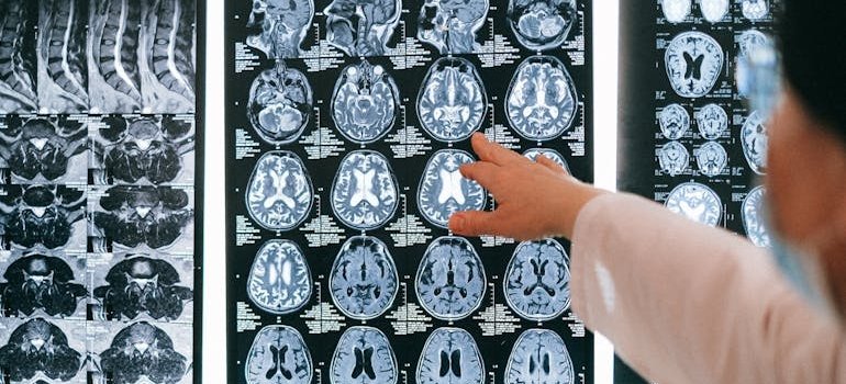 Doctor pointing to a brain scan while explaining how addiction changes the brain.